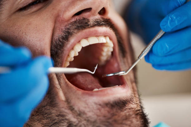 Best Emergency Care for Gum Disease in Ckam Housing, HI